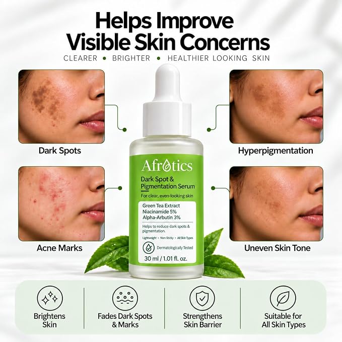 AFROTICS Dark Spot & Pigmentation Serum-30 ml