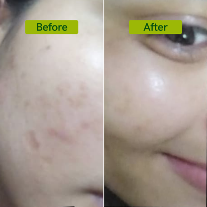 AFROTICS OILY & ACNE FACE WASH